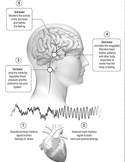 Diagram showing the connection between heart rhythms, brain functions, and emotional stress levels.